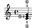 [image of music]