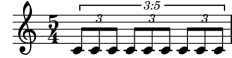 [image of music]